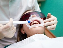 Female receiving in-office teeth whitening