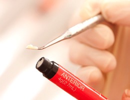 An up-close view of a dentist uses a small amount of composite resin for dental bonding