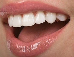 An up-close view of a person’s top arch of teeth that are healthy and beautiful