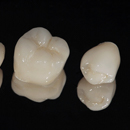 Image of three different tooth-colored dental crowns that are free of any metal