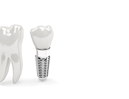 A digital image of a dental implant standing up next to a natural tooth