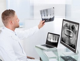 Castle Rock implant dentist looking at X-rays 