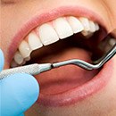Closeup of teeth during dental exam