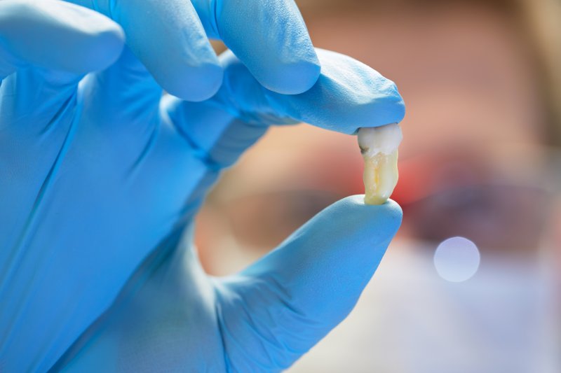 an extracted tooth
